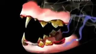 Why Is It Important To Remove Plaque From My Cat's Teeth?