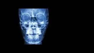 X Ray's uses