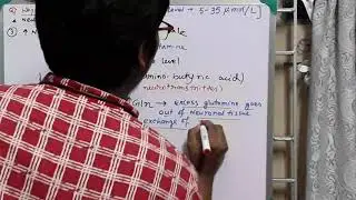 Why ammonia(NH3) is toxic to brain?