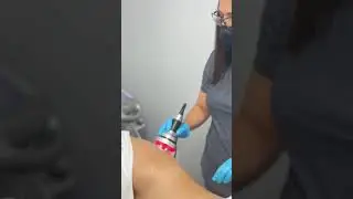 Laser & Skin Clinic - Radio Frecuencia