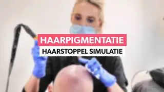 Opmerkelijke oplossing bij volledige kaalheid