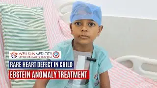 Ebstein Anomaly in Child | Rare Congenital Heart Disease Treatment