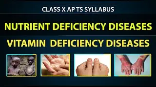 #Vitamin DEFICIENCY DISEASES | Class 10th Nutrition biology |Science Syllabus |eduscope 10th biology