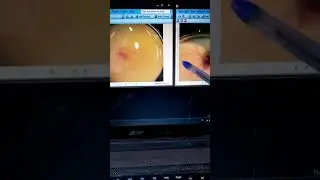 تعرف على سبب هلاك اجنة البيض ان كان من المفقسه ام من البيض