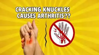 Fact or Fiction: Cracking Knuckles Causes Arthritis