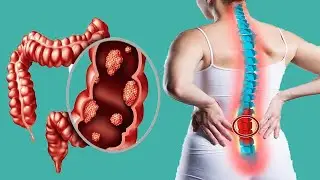 Lower Back Pain And Constipation: Are Both Related?