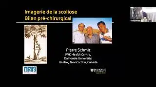 lmagerie de la scoliose - Bilan pré-chirurgical
