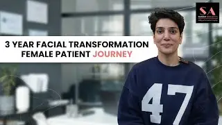 Upper & Lower Blepharoplasty, Necklift & Laser Treatment  3 Years Genuine Patient Testimonial