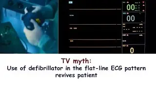TV myth: Use of defibrillator in the flat-line ECG pattern revives patient
