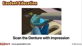 Scan the Denture with Impression