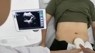 BProbe-2 | Portable Bladder Ultrasound Scanner