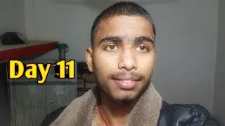 Day 11 😮 | Hair Growth Journey continues&hellip; Real change starts now! 💪✨