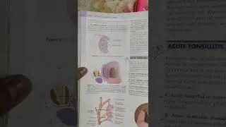 Throat 2. Acute and Chronic Tonsillitis | ENT
