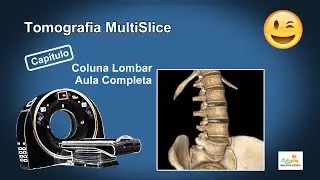 Tomografia da Coluna Lombar (Dicas e Truques!)