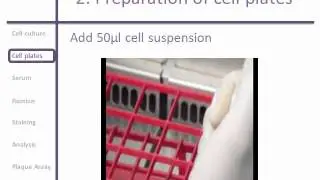 Plaque Reduction Micro Neutralization Assay for Dengue viruses