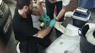 &Epsilon;&pi;&iota;&sigma;&kappa;&epsilon;&upsilon;ή &Alpha;&pi;&omicron;&chi;έ&tau;&epsilon;&upsilon;&sigma;&eta;&sigmaf; &chi;&omega;&rho;ί&sigmaf; &Sigma;&kappa;ά&psi;&iota;&mu;&omicron; (Relining) | &Pi;&omicron;&lambda;&upsilon;&kappa;&alpha;&tau;&omicron;&iota;&kappa;ί&alpha; &sigma;&tau;&omicron;&nu; &Rho;έ&nu;&tau;&eta;
