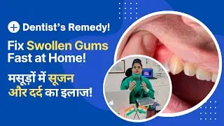 Fix Swollen Gums Fast at Home Near Wisdom Tooth(Dentist&rsquo;s Remedy)