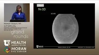 Systemic Vasculitis with Uncommon Ocular Findings