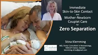Klemming Zero Separation July 2025