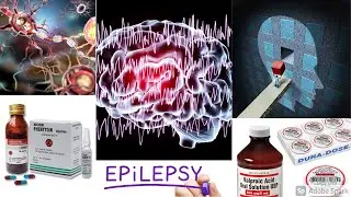 Antiepileptic Drugs