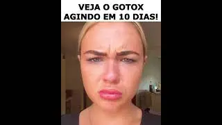 GOTOX - Botox em Gotas - Anti Rugas