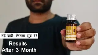 Ustraa Beard growth oil Review in Hindi (2022) - 3 Months Result