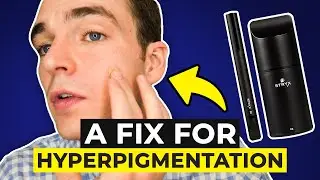 A Quick Fix for Hyperpigmentation | Better Skincare for Men