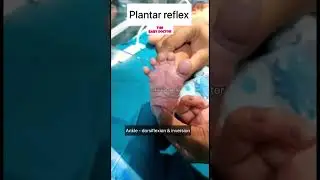 Компоненты подошвенного рефлекса у новорожденных | рефлекс #thebabydoctor #babyvideos #newborn #s...