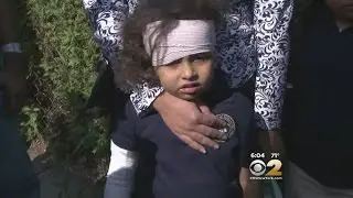 Dog Attacks Girl In Bayonne