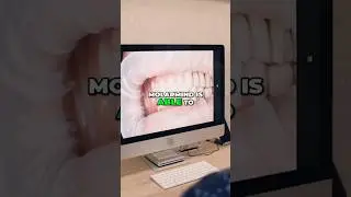 Dental AI: See X-Ray Defects in Under 3 Seconds!