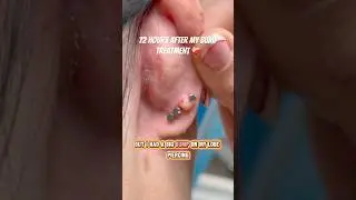 На моем собственном пути исцеления ❤️&zwj;🩹 @baselaboratories