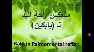 منعكس راحة اليد لـ بابكين