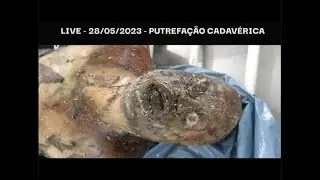 Quais s&atilde;o as fases da putrefa&ccedil;&atilde;o do corpo humano