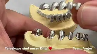 DENTALLIGENT PRAXIS by Michael Anger - Teleskope sind unser Ding. #shorts