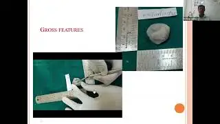 POPMA-SC-19 (2025): Diagnostic Pathways: Clinico-pathological cases in Oral Pathology Practice