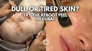 Dull or Tired Skin? Try the Reboot Peel in Dubai | SKIN CLINIC IN DUBAI #Dubai #koreanskincare #uae