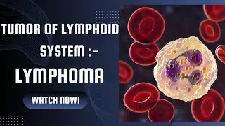 Lymphoma | immunology | Microbiology in Marathi