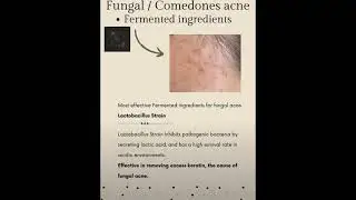 Fermented Ingredients Explained for Fungal Acne ! - #fermented #fungalacne #acne #acneproneskin