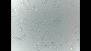 Human cell growth (HEK-293) - ioLight microscope inside incubator