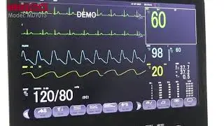 How to connect a Patient monitor to Central Monitoring System !