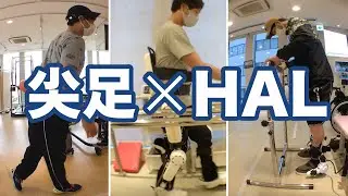 HALによるアプローチ：脳性麻痺の方の 尖足（つま先歩行）