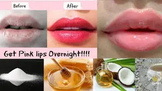 Best way to get Pink and Soft Lips at Home #BeautyUtsav #Shorts #YoutubeShorts