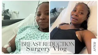 Breast Reduction Surgery Day Vlog | What to expect on the day of your breast reduction surgery