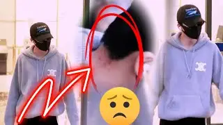 OMG! Liu Yuning Appears With a Neck Injury &mdash; Fans Fear He&rsquo;s Overworked and Exhausted