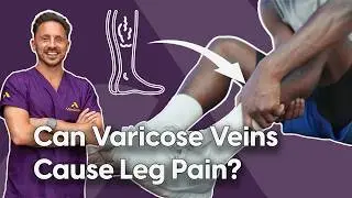 Can Varicose Veins Cause Leg Pain?