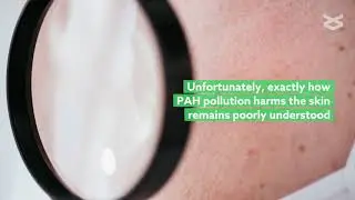 Human skin microbes change following chronic exposure to environmental pollutants