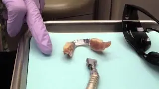Broken Partial Denture-When to repair