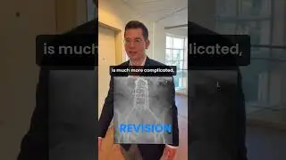 My Take on Revision Fusion Surgery