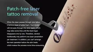 Latest Black Technology - Skin Protection Patch: Reduce Pain, Improve effect and fasten healing
