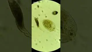 Dileptus Cell Attacks Stentor Cell Under Microscope